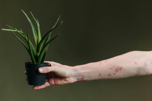 Dealing with Eczema - What Doctors Don't Tell You | Change Your Detergent